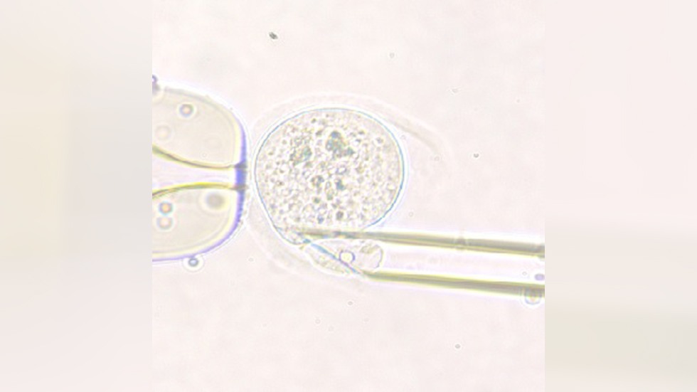 Mouse Oocyte Polar Body Biopsy